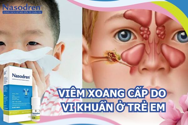 viêm xoang cấp do vi khuẩn ở trẻ em 2