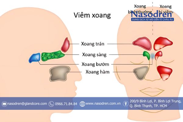 vị trí các xoang